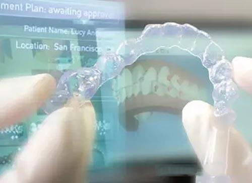 上海888集团牙模3D打印机推荐打印案例