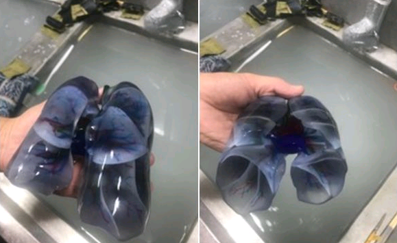 3D打印技术为医疗行业带来的革新