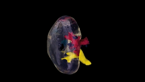 3D打印技术为医疗行业带来的革新